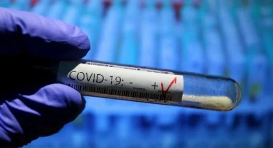 Близо 100 починали от COVID-19 за ден