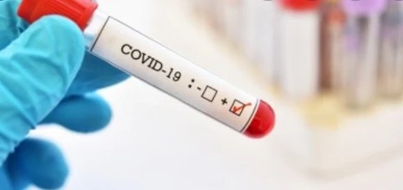 Над 4800 нови случая на COVID-19, починалите са 136