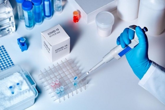 Проект предвижда НЗОК да заплаща тестовете за антитела за COVID-19