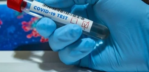 2105 са новите случаи на COVID-19 у нас