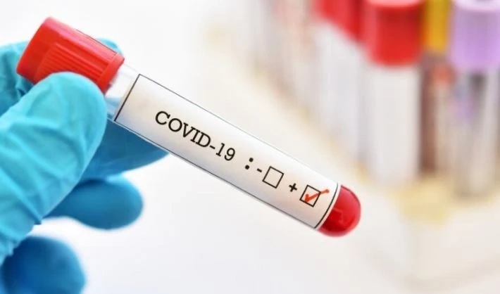 743 нови случая с COVID-19 за последното денонощие