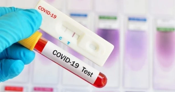 3176 нови случая на COVID-19 у нас