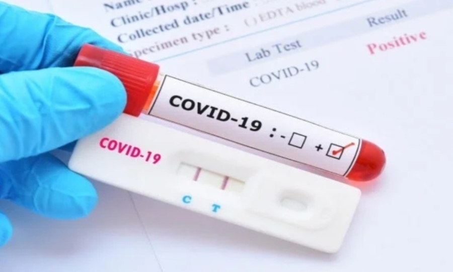 Над 2 300 нови случая на COVID-19
