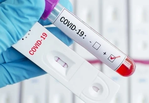 Близо 10 000 са новите случаи на COVID-19
