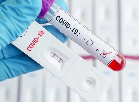 11 143 са новите случаи на COVID-19