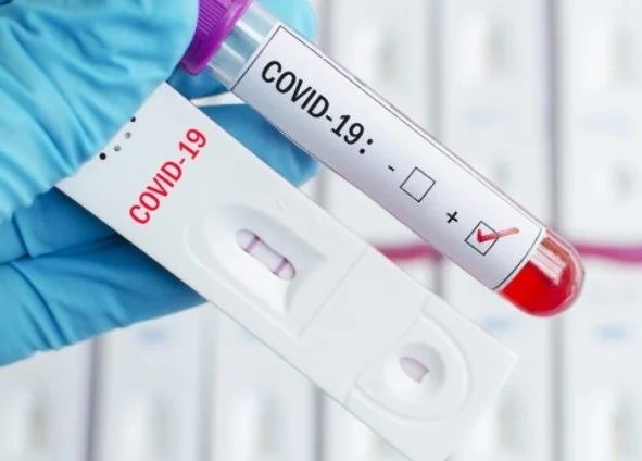 2181 нови случая на COVID-19 за последното денонощие