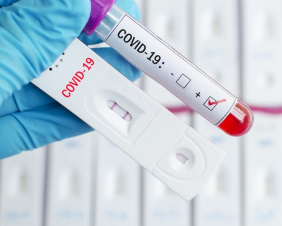 724 са новите случаи на коронавирус