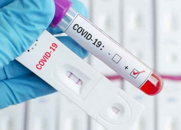 Близо 2300 нови случая на COVID-19