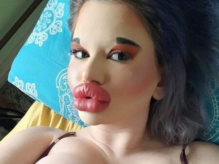 Бургаскато барби с три нови операции за ден