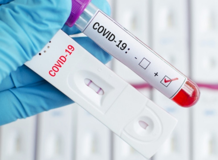 2462 са новите случаи на коронавирус