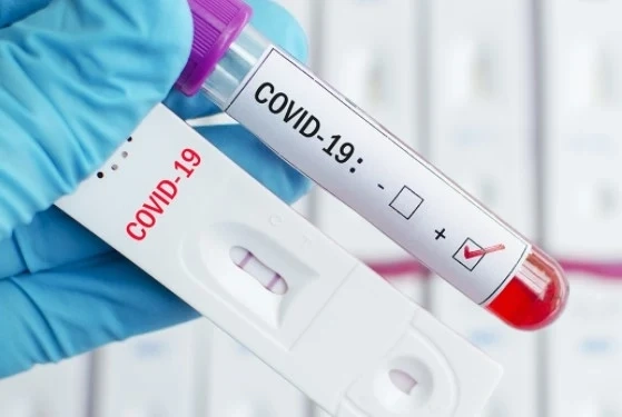 1552 са новите случаи на COVID-19 у нас