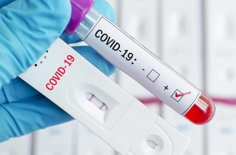 1176 са новите случаи на COVID-19
