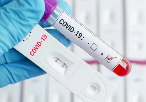 1033 нови случая на COVID-19 у нас