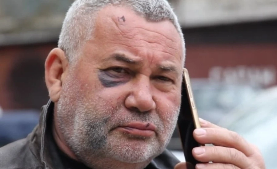 Мирчев пита Рашков за разследването срещу Илиян Събев за побоя над кмета на Белгун