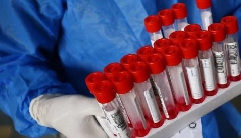 265 са новите случаи на коронавирус
