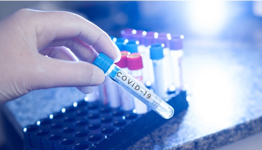 550 нови случая на COVID-19 у нас