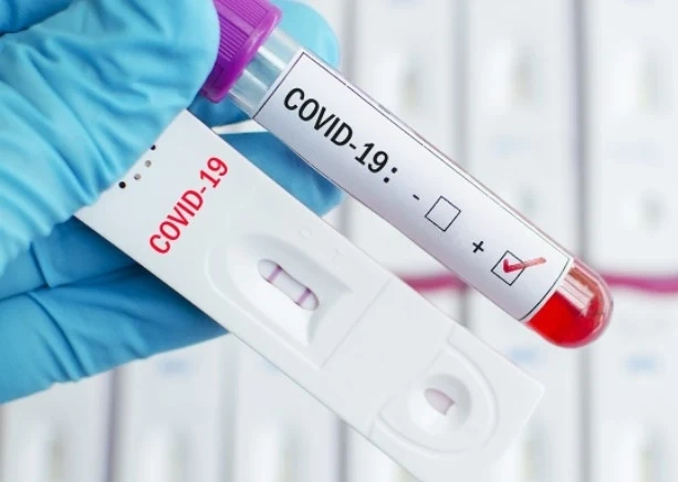 313 са новите случаи на COVID-19 у нас
