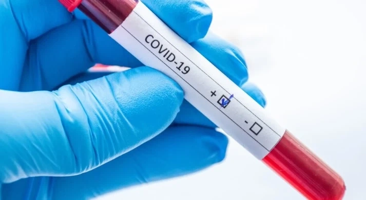 457 нови случая на COVID-19 у нас