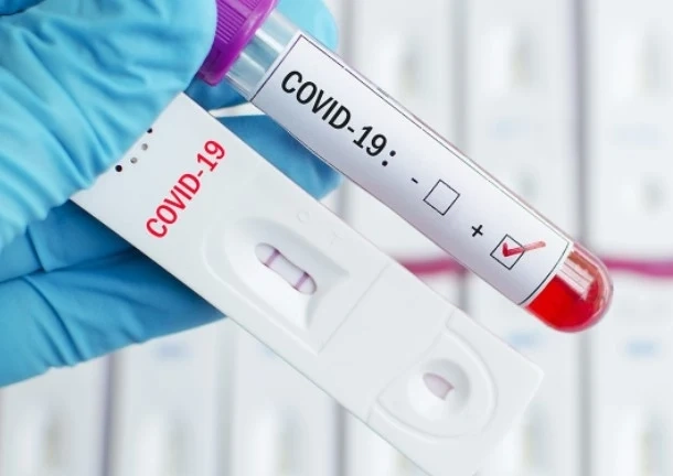 96 нови случая на COVID-19 у нас