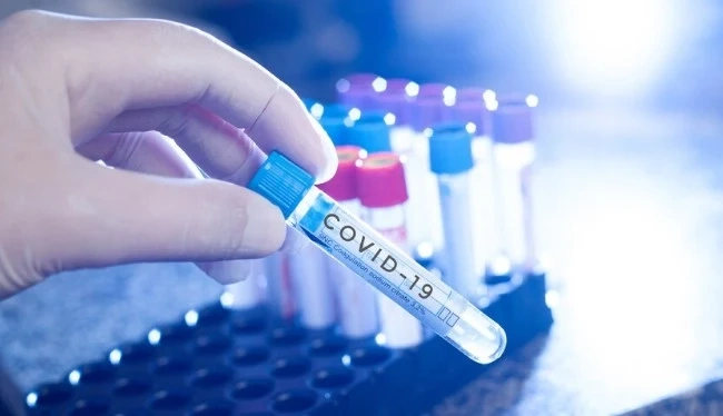 236 нови случая на COVID-19 у нас за последното денонощие