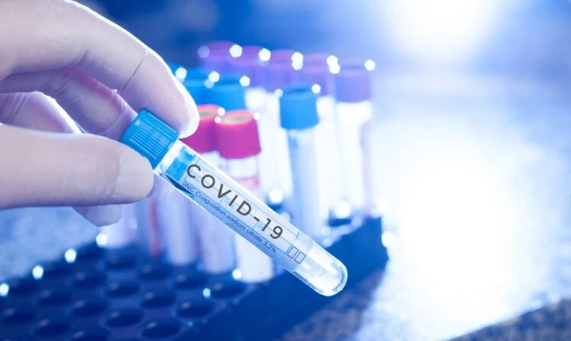 189 са новите случаи на COVID-19 у нас