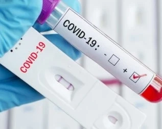 240 са новите случаи на COVID-19 у нас