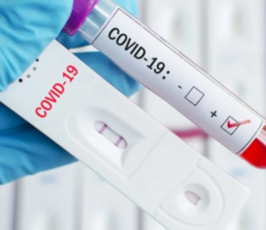 COVID-19: Близо 400 нови случая у нас