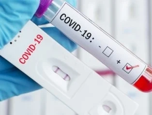 549 са новите случаи на COVID-19 у нас