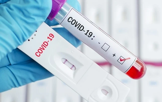 Над 20% от пробите за COVID-19 са положителни