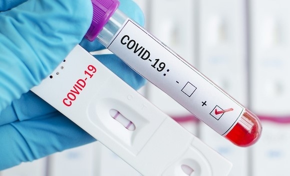 937 са новите случаи на коронавирус. Починалите от инфекцията са 6