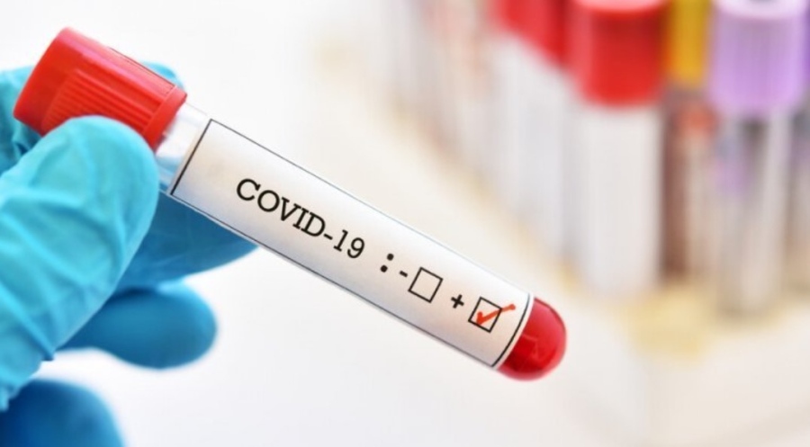 215 са новите случаи на COVID-19