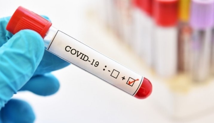 73 са новите случаи на коронавирус