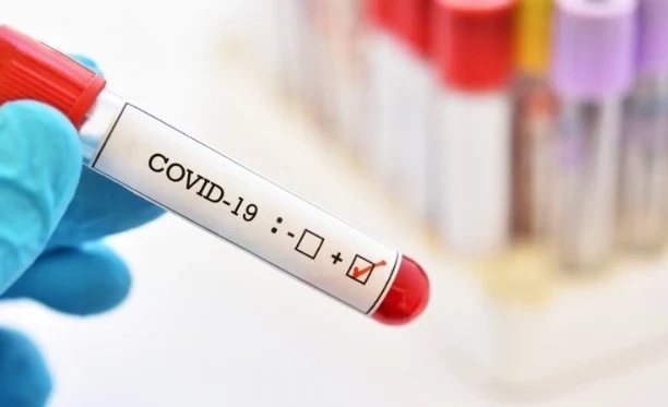 Случаите на COVID-19 у нас бързо нарастват