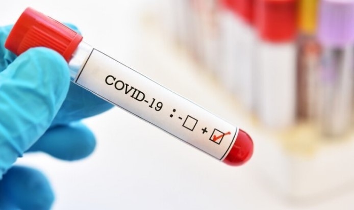 137 са новите случаи на коронавирус