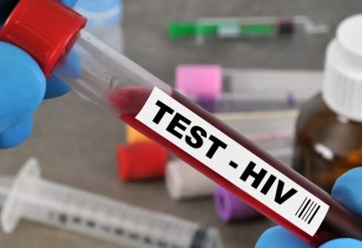 Излекуваха болен от ХИВ чрез трансплантация на стволови клетки