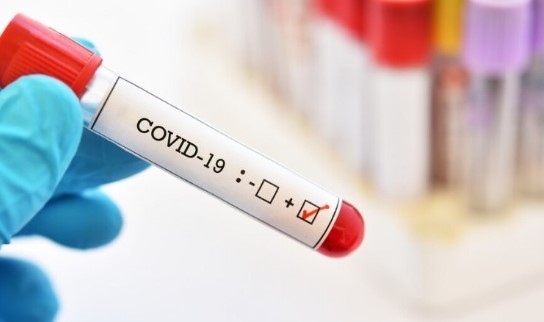 255 са новите случаи на COVID-19 у нас