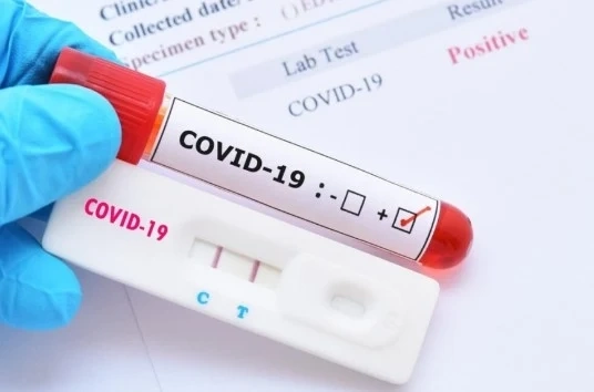 COVID-19: Новите случаи са 366, починалите са 8