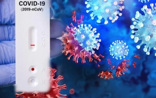 Болните от COVID-19 у нас са много, но не се тестват