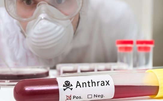 Заради случая с антракс: 24 души се лекуват превантивно с антибиотици и са под медицинско наблюдение 